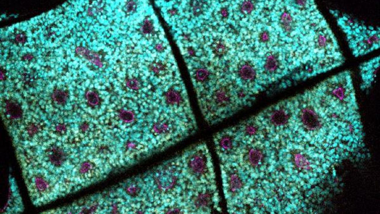 Dokudan minyatür organ üretimi ile Parkinson’a kalıcı çözüm arıyorlar