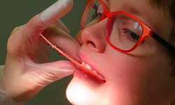Çocukların Süt Dişlerindeki Çürükler Tedavi Edilmeli
