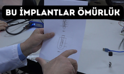 Rize'de  ‘Akıllı İmplant Projesi' İle İmplantların Ömrü Uzatıldı