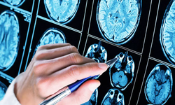Yapay zeka entegrasyonlu MR cihazları ‘Alzheimer’ı erken sezebilecek