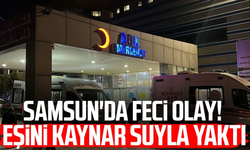 Eşini Kaynar Suyla Yaktı