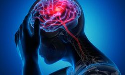 Gençlerde De Risk Artıyor: İnme Vakalarının Yüzde 17'si 50 Yaş Altında