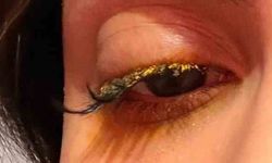 Güzellik Merkezinde Genç Kadının Gözüne Yapıştırıcı Kaçtı: "Kör Olabilirdim