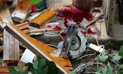 Bacağını Elektrikli Testereye Kaptıran Yaşlı Adam Ağır Yaralandı