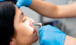 Burun Eti Sorununa Radyo Frekansla Etkili Çözüm