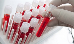 Bir Test Bir Hayat Kurtardı