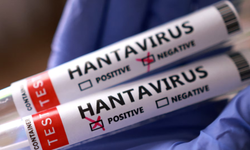 Hantavirüs Korkusu Artarken Uzmanlardan Hijyen Çağrısı