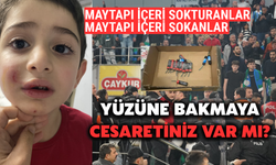 Yüzüne Bakmaya Cesaretiniz Var Mı?