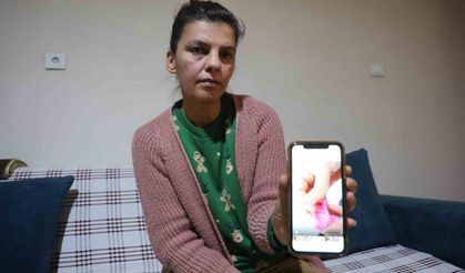 Çocuklara Aldığı Oyun Hamurunu Verdi, Elleri Kan İçinde Kaldı!