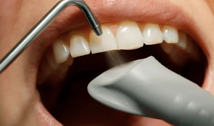 Sosyal Medyada Yaygınlaşan Diş Ürünleri Tehlike Saçıyor