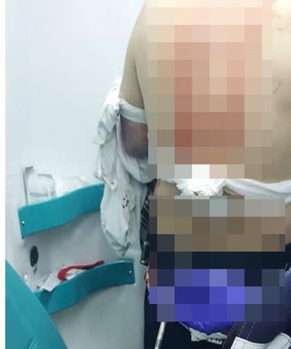 Abisini Sokak Ortasında Silahla Vurarak Öldürdü