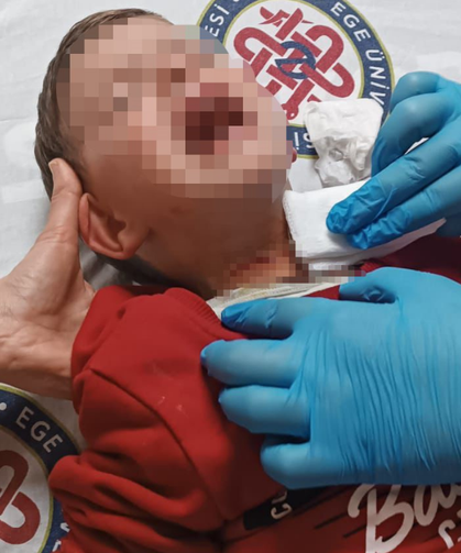 Parkta Oynayan 2 Yaşındaki Çocuğa Bıçaklı Saldırı