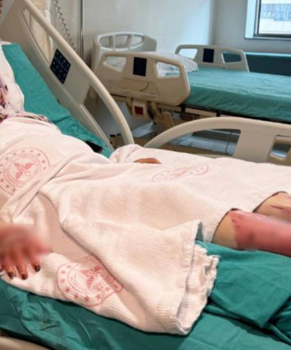 Karavandaki Patlama Sonrası Vücudunun Yüzde 70’i Yandı: "Karadeniz Turu Yapacaktık, Alev Topuna Döndüm