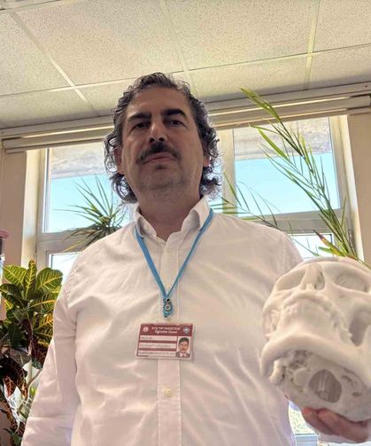 Beyin Tümörü Ameliyatı Sonrası Çöken Alnı, 3 Boyutlu İmplantla Düzeltildi