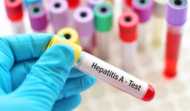 Rize İl Sağlık Müdürlüğü'nden Dünya Hepatit Günü Bilgilendirmesi