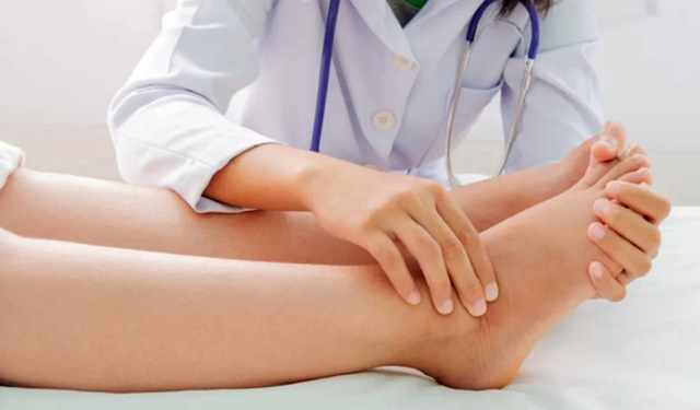 Ödemle Baş Etmenin Etkili Yolları