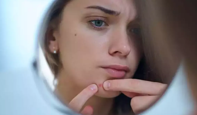 Soğuk Havalarda En Çok Görülen Cilt Hastalıkları