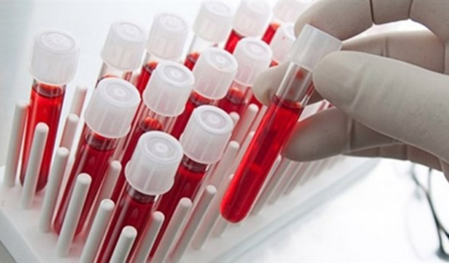 Bir Test Bir Hayat Kurtardı