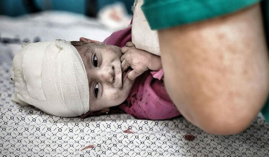 Gazze'de Yaralanan Çocuklar Objektiflere Böyle Yansıdı