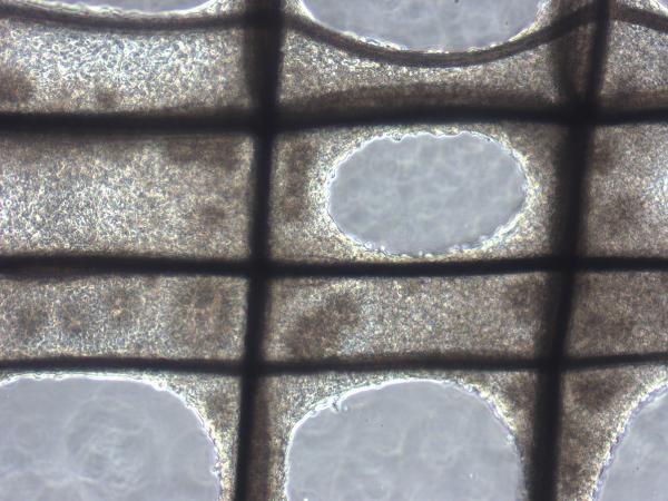 Dokudan minyatür organ üretimi ile Parkinson’a kalıcı çözüm arıyorlar
