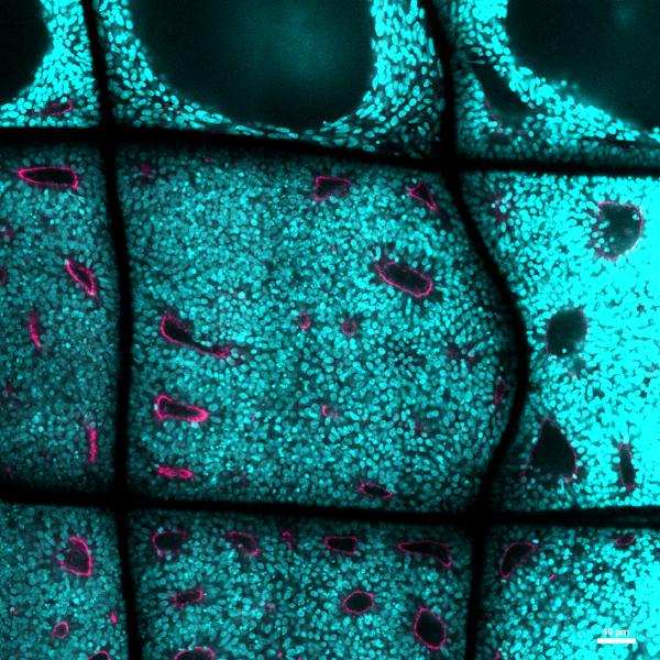 Dokudan minyatür organ üretimi ile Parkinson’a kalıcı çözüm arıyorlar
