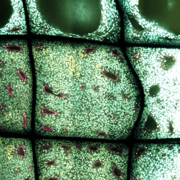 Dokudan minyatür organ üretimi ile Parkinson’a kalıcı çözüm arıyorlar