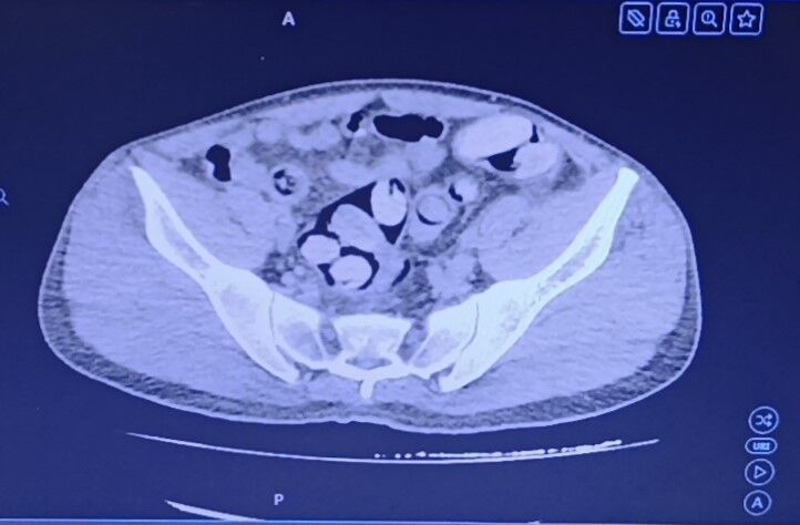 Midensinden Çıkan 1 Kilo Uyuşturucu Şoke Etti